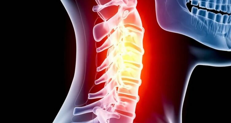 Cervical eskualdearen hantura
