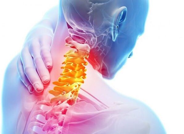 Bizkarrezurreko bizkarrezurraren osteokondrosia