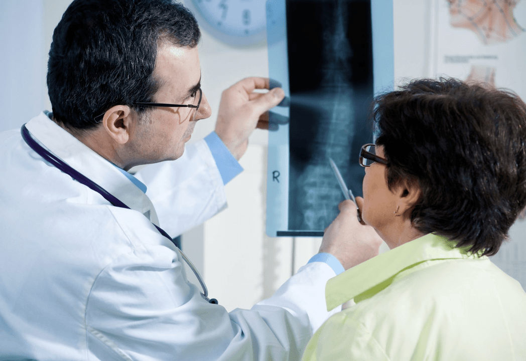 Neurologo batek osteokondrosia diagnostikatzen du bizkarrezurraren erradiografia erabiliz