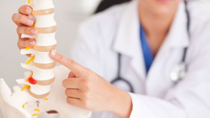 lumbar osteokondrosiaren azalpena bizkarrezurreko eredu batean